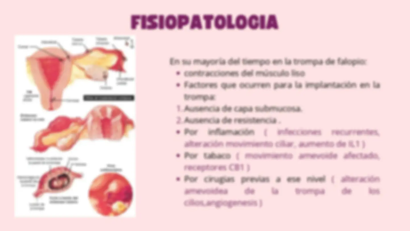 pf5