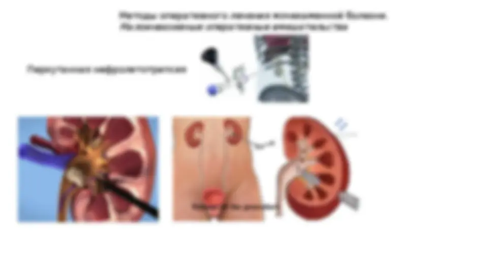 pf15
