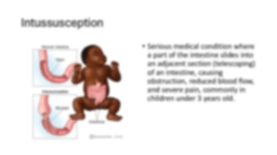 pf48