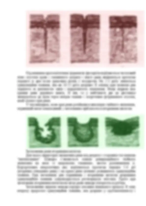 pf13