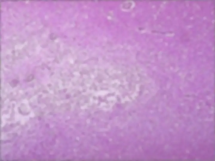 pf38
