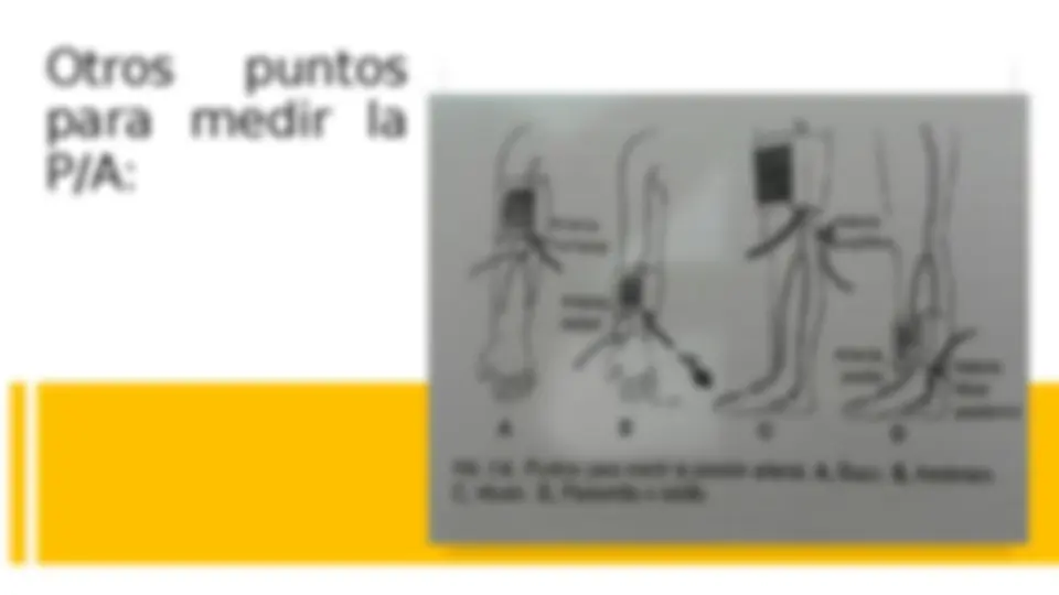 pf5