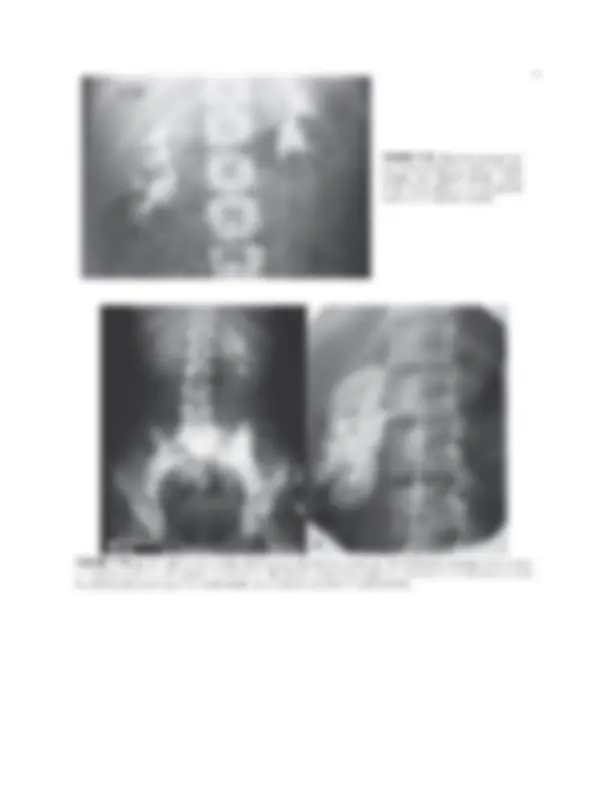 pf13