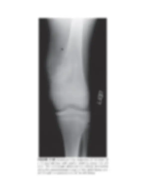 pf12