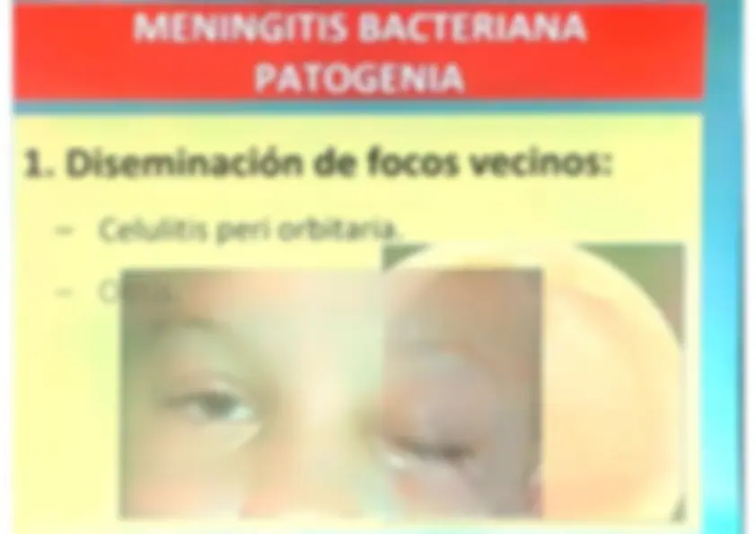 pff