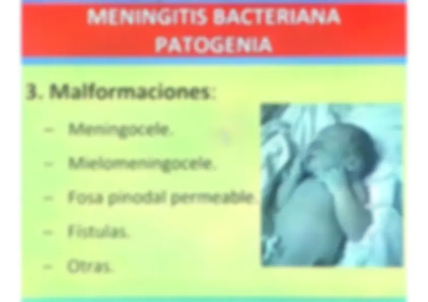 pf14
