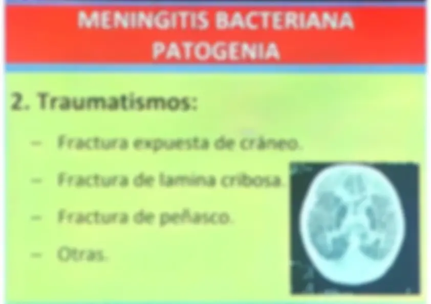 pf13