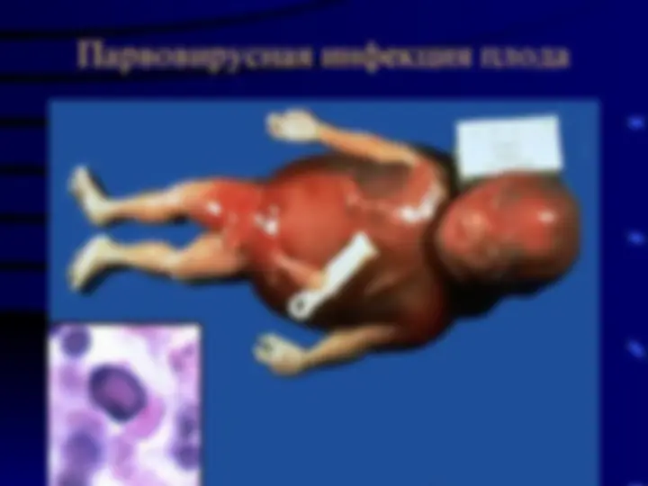 pf34