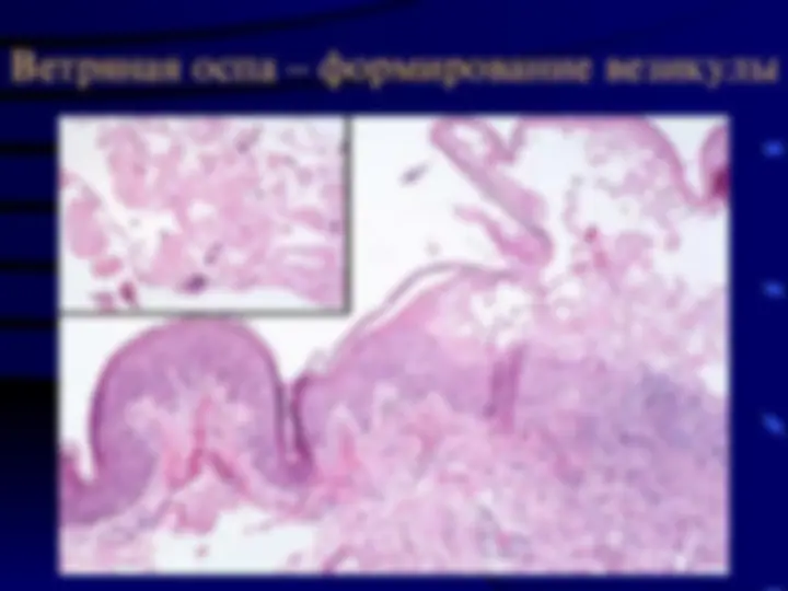 pf31