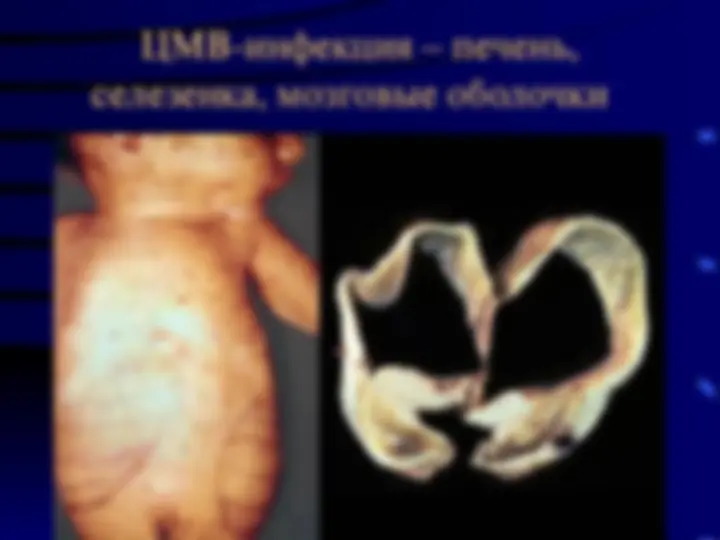 pf33