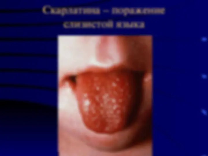 pf1a