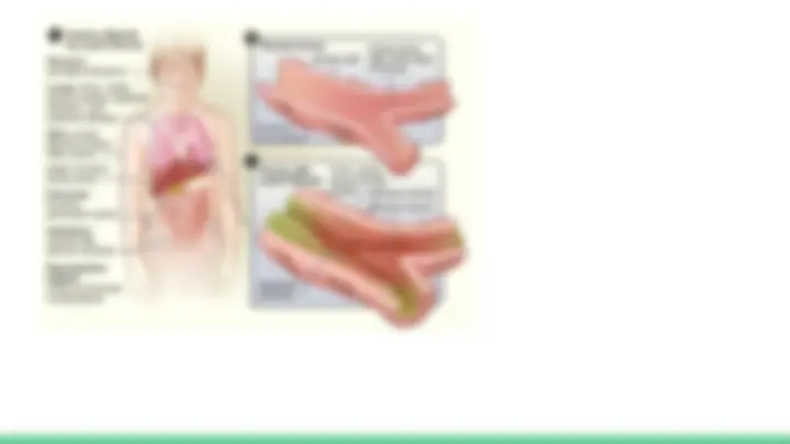 pfe