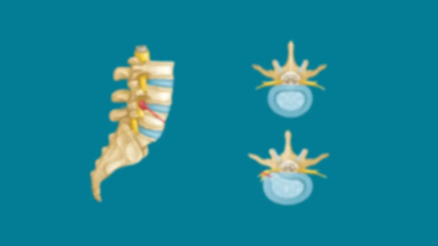 pf5