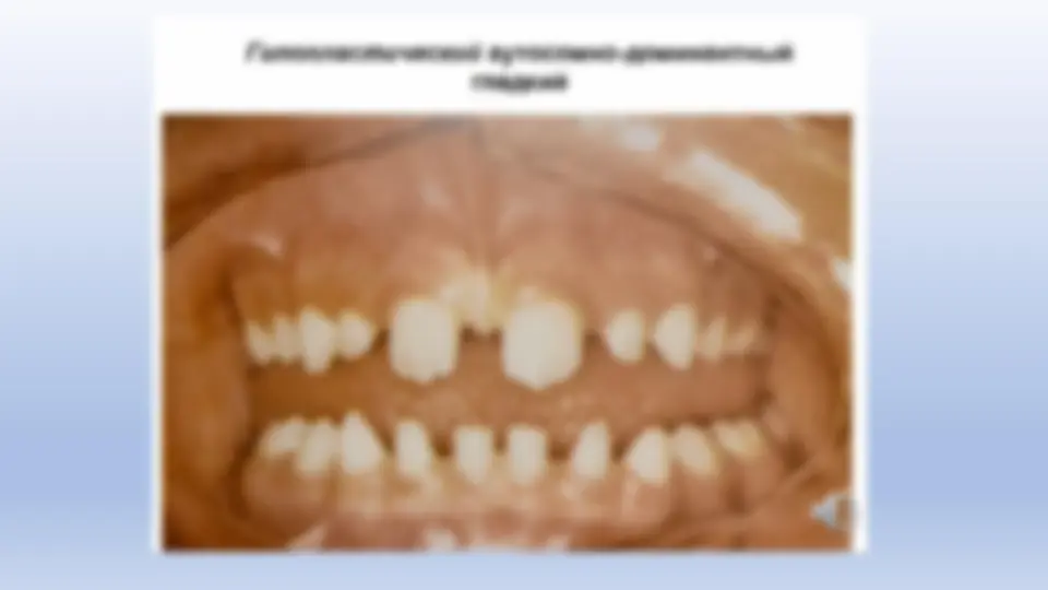pf14