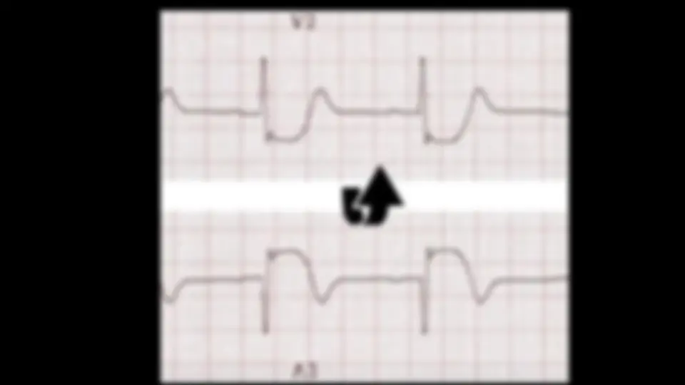 pf33