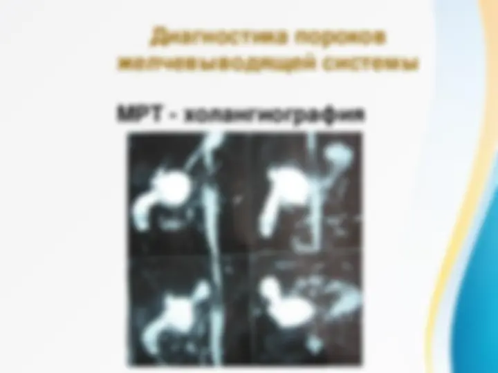 pf16