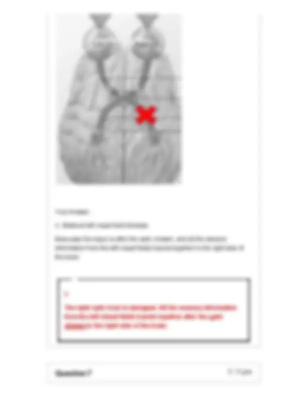 BIOD 152 Module 3 Exam Questions & Answers (2026/2027) | Anatomy ...