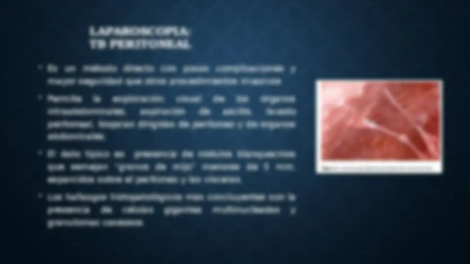 pfd
