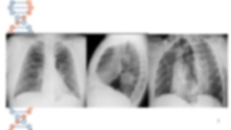 pf5