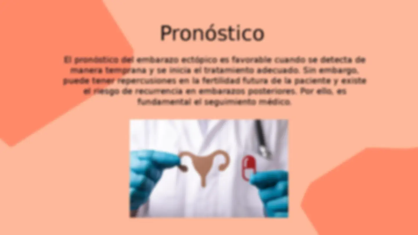 pfe