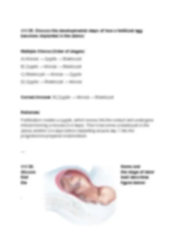 BIOD 152 Module 6 Exam (PDF) | (2026/2027) A&P II Questions | Anatomy ...
