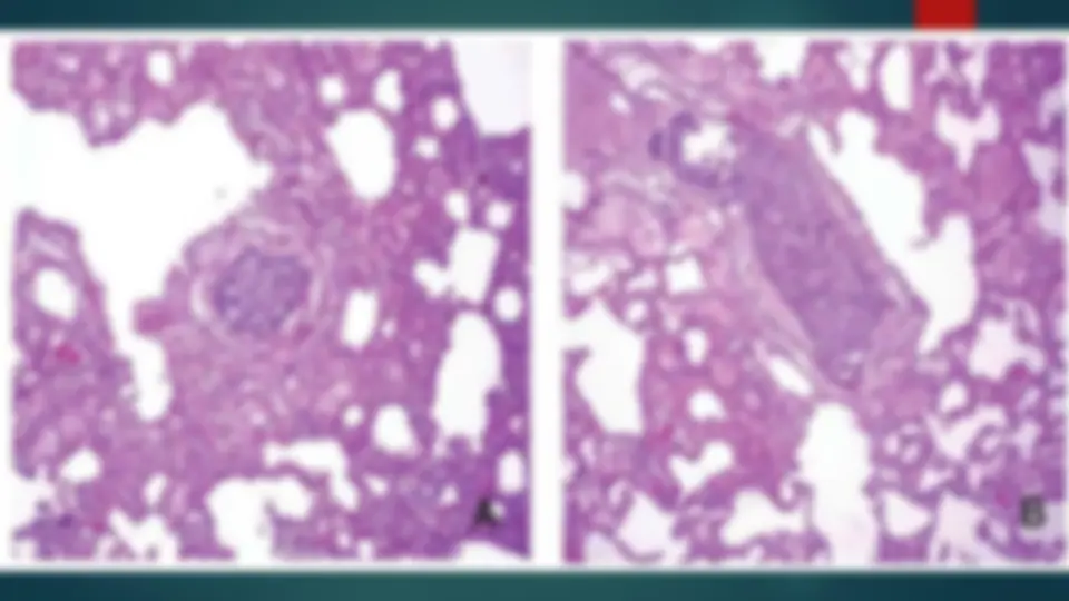 pf26