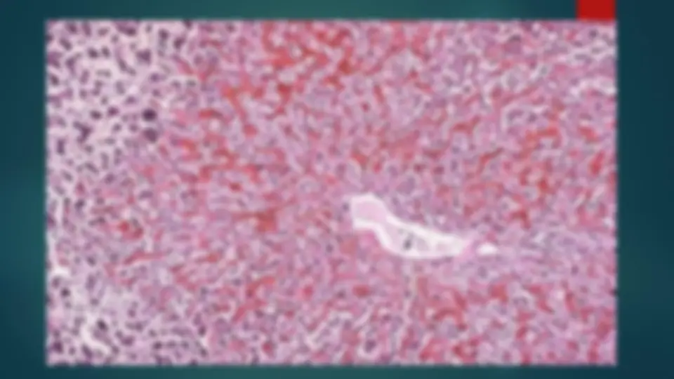 pf1f
