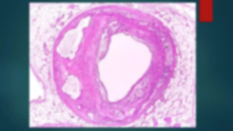 pf2a