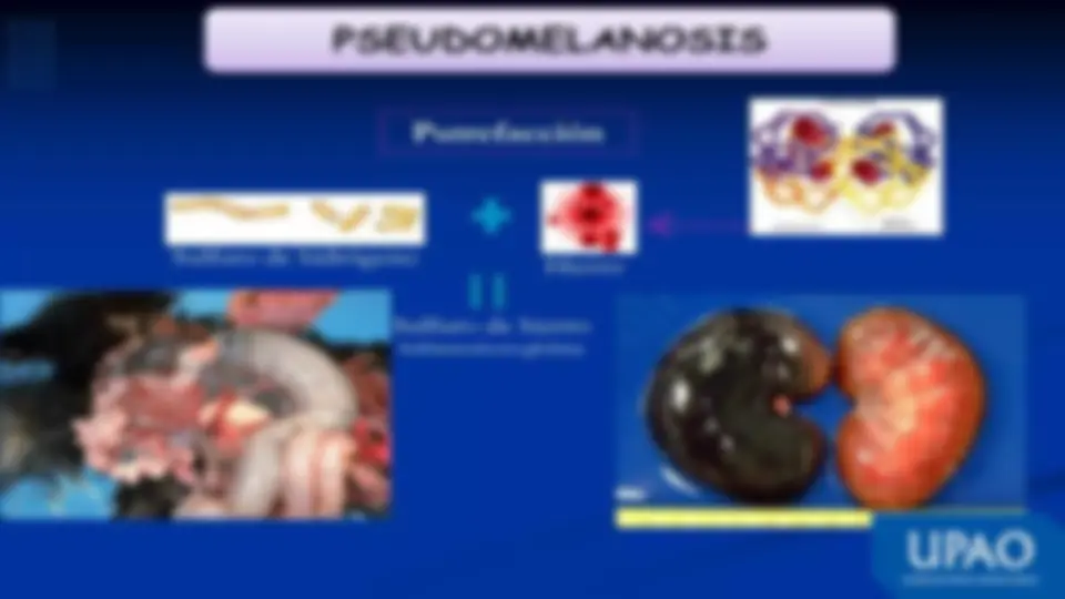 pf20