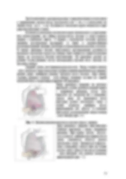 pfa