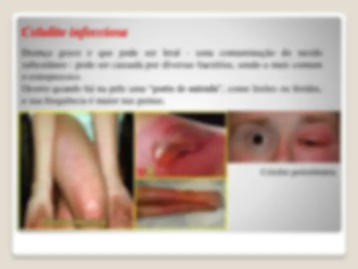 pf33