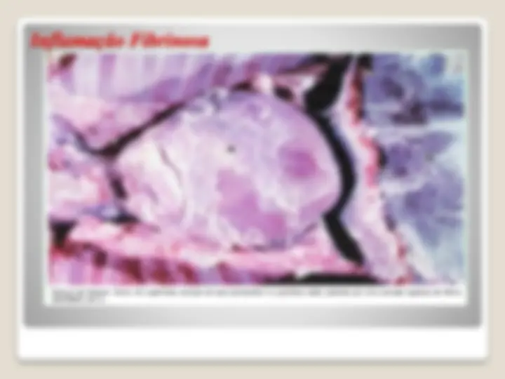 pf2a