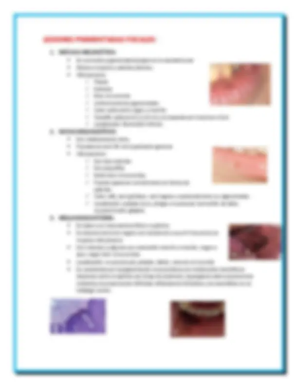 LESIONES PIGMENTADAS EN CAVIDAD BUCAL Y LA IMPORTANCIA DE UN DIAGNOSTICO | Resmenes de Medicina | Docsity LESIONES PIGMENTADAS EN CAVIDAD BUCAL Y LA IMPORTANCIA DE UN DIAGNOSTICO | Resmenes de Medicina | Docsity