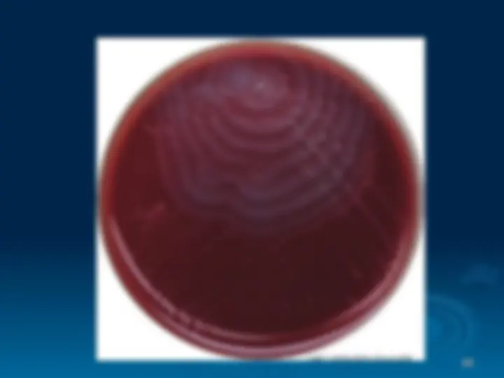 pf41