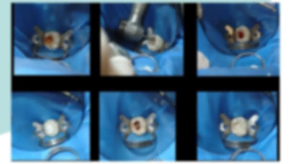 pf3b