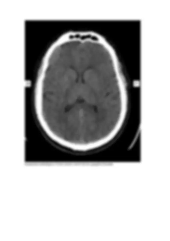 pfa