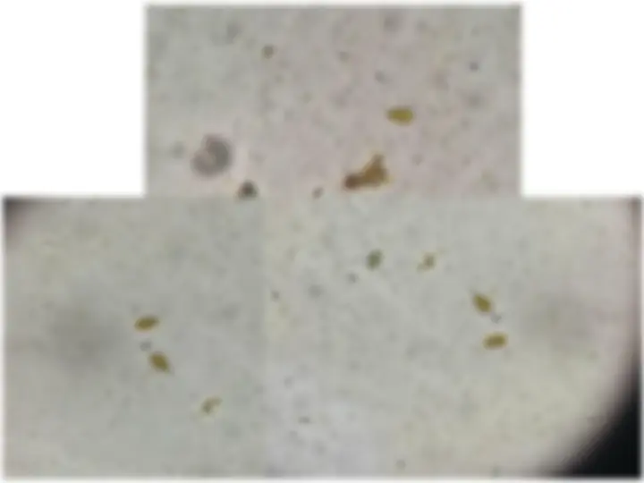 pf40
