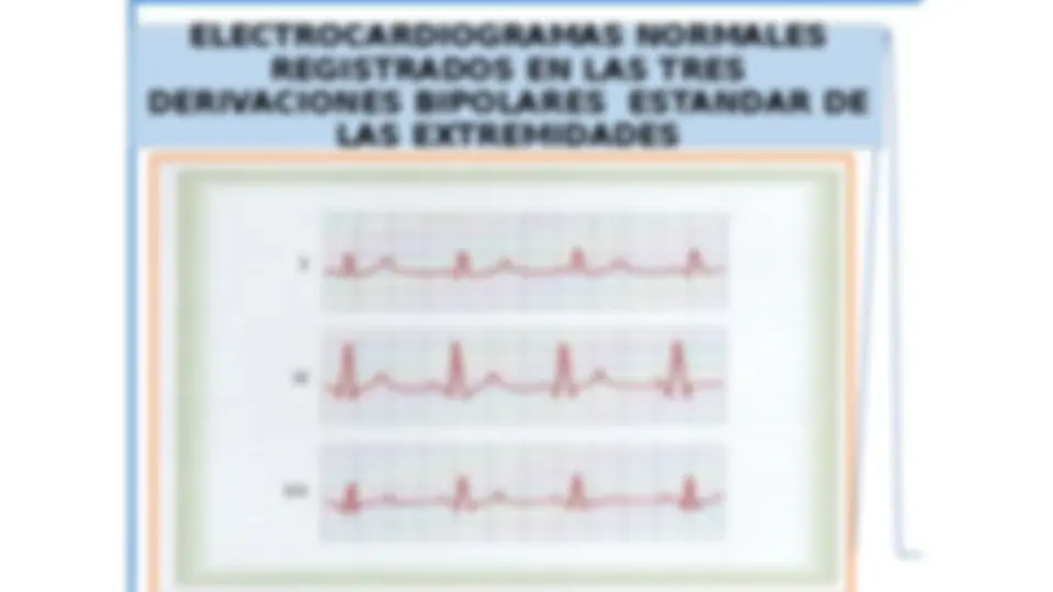 pfe