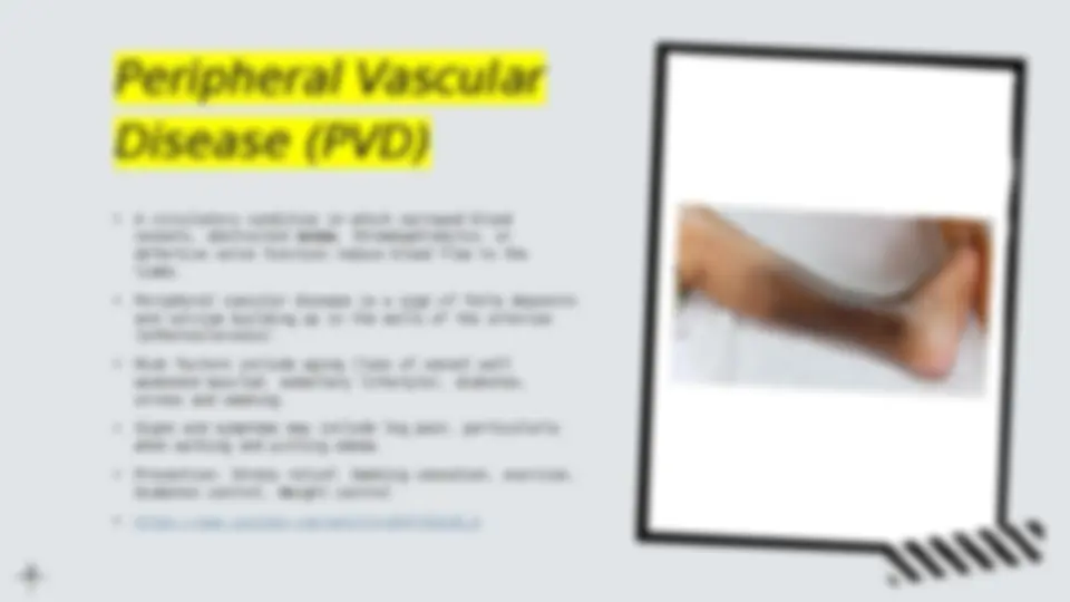 pfd