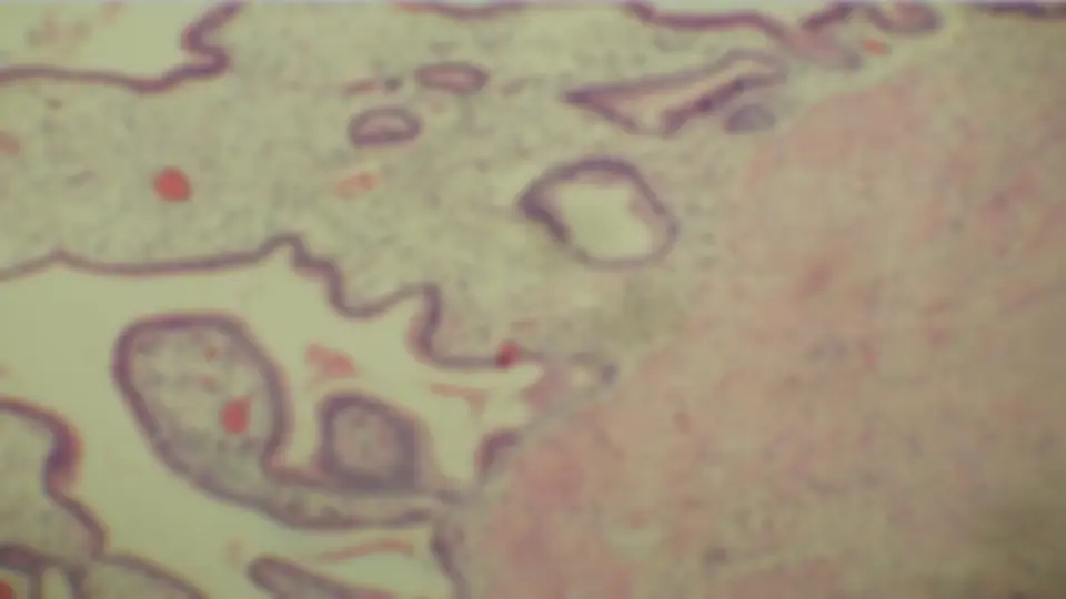 pf5