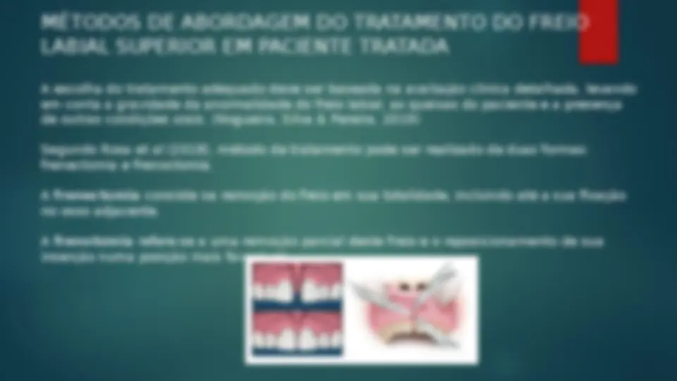 pfd
