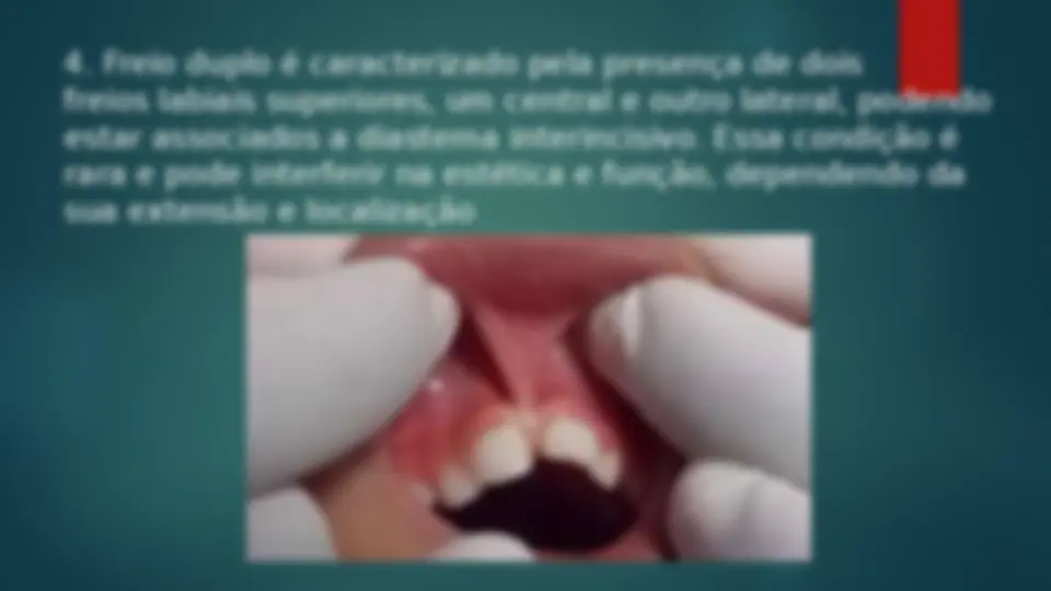 pfa