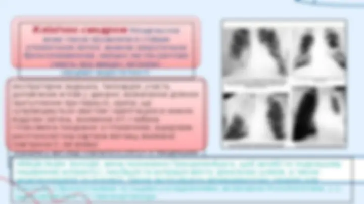 pfa