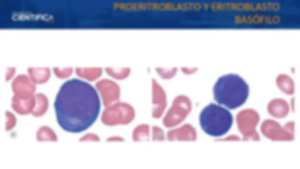 pf18