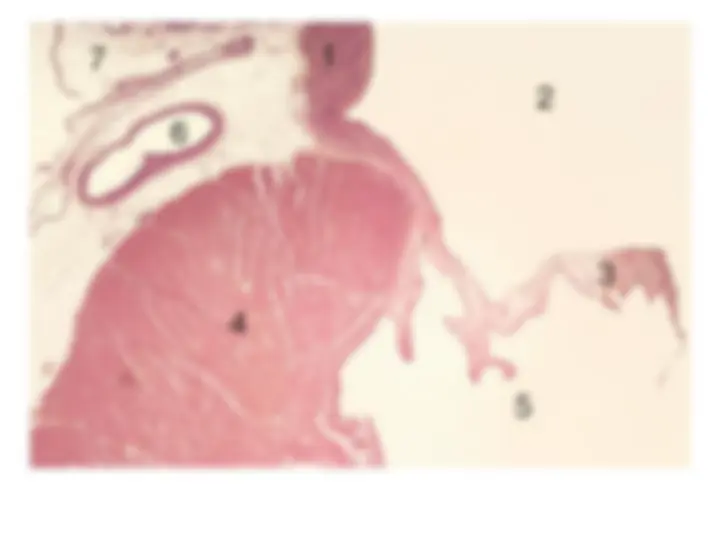 pf5f