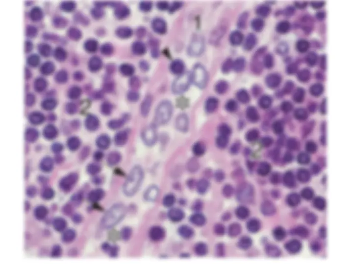 pf34