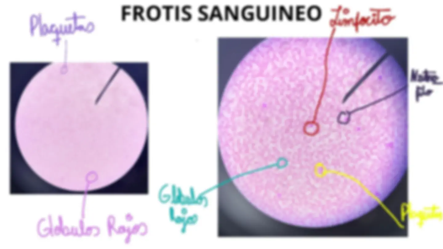 pf5