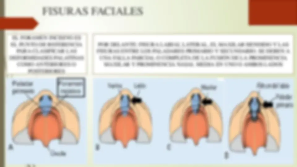 pf2a