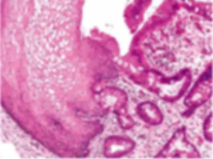 pf15
