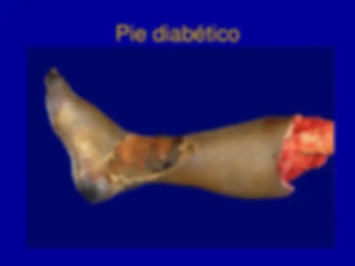 pf37
